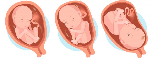 Les examens du 3e mois de grossesse - Grossesse mois par mois - Doctissimo